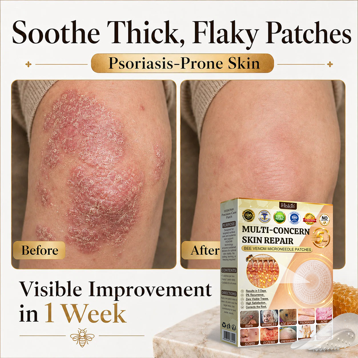 🎁 YOU’VE UNLOCKED A SPECIAL CUSTOMER BONUS! Pair Your HISKIN® Pen With Repair Patches For A Complete At-Home Skin Care Routine — Now 50% OFF!