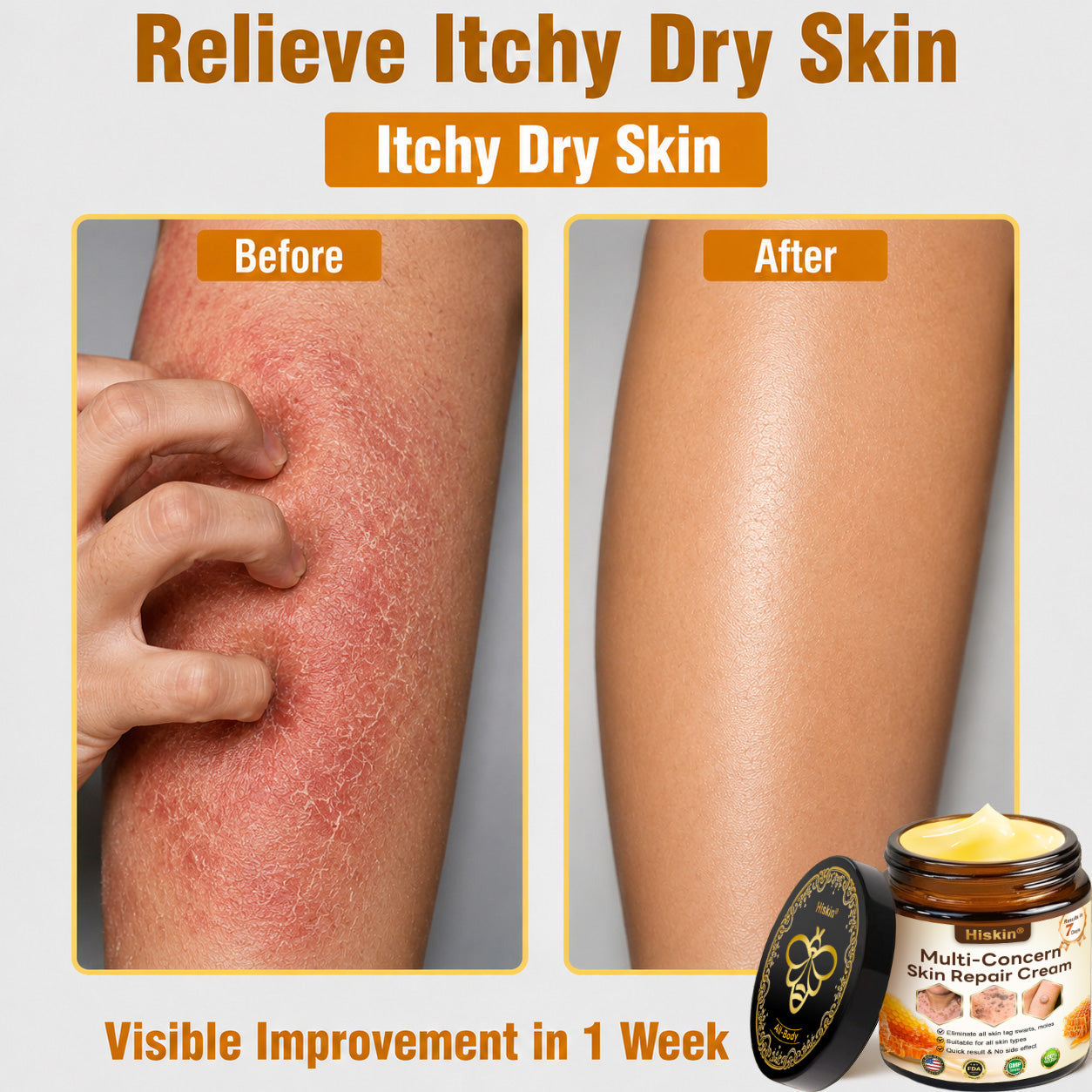 🎁 DON’T LEAVE THIS VIP DEAL BEHIND 80% OFF HISKIN® Skin Repair Cream | Smooth The Look Of Wrinkles, Hydrate & Restore A Youthful Glow + 180-Day Guarantee