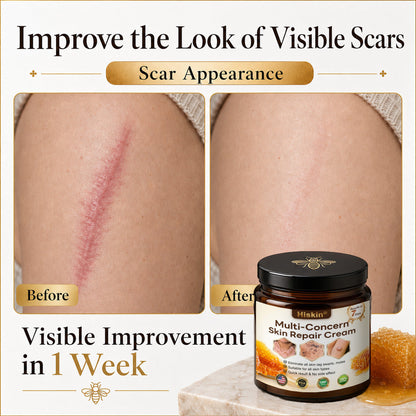 🎁 DON’T LEAVE THIS VIP DEAL BEHIND 80% OFF HISKIN® Skin Repair Cream | Smooth The Look Of Wrinkles, Hydrate & Restore A Youthful Glow + 180-Day Guarantee