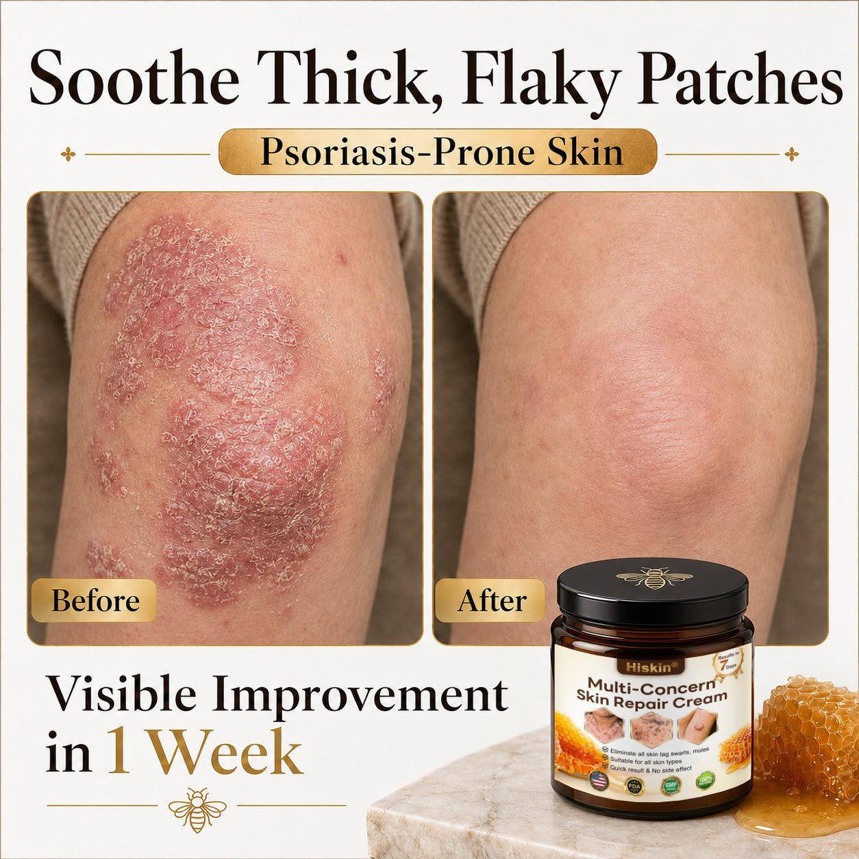 🎁 DON’T LEAVE THIS VIP DEAL BEHIND 80% OFF HISKIN® Skin Repair Cream | Smooth The Look Of Wrinkles, Hydrate & Restore A Youthful Glow + 180-Day Guarantee