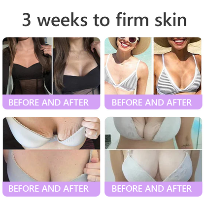 𝐇𝐈𝐒𝐊𝐈𝐍® 𝐏𝐃𝐑𝐍 𝐌𝐮𝐥𝐭𝐢-𝐏𝐞𝐩𝐭𝐢𝐝𝐞 𝐌𝐚𝐬𝐬𝐚𝐠𝐢𝐧𝐠 𝐁𝐨𝐝𝐲 𝐑𝐨𝐥𝐥𝐞𝐫 𝐂𝐫𝐞𝐚𝐦- Anti-aging, Hydrating, Skin Firming & Lifting, Skin Repair, Even Tone, Acne and Dark Spot Treatment, Wart and Mole Removal, and Psoriasis Relief.