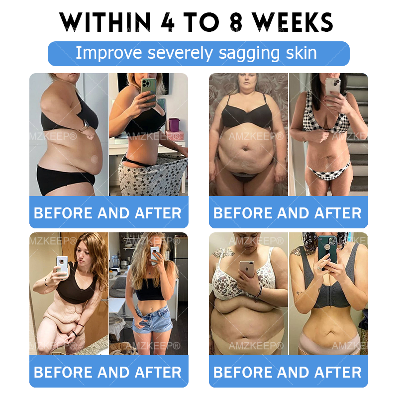 𝐀𝗠𝒁𝑲𝗘𝑬𝙋® 𝐀𝗠𝗣𝑲*𝐌𝗼𝗿𝗶𝗻𝗴𝗮*𝐁𝗲𝗿𝗯𝗲𝗿𝗶𝗻𝗲 𝟏𝟎-𝗶𝗻-𝟏 𝐌𝗲𝘁𝗮𝗯𝗼𝗹𝗶𝗰 𝐒𝘂𝗽𝗽𝗼𝗿𝘁 𝐍𝗮𝗻𝗼 𝐌𝗶𝗰𝗿𝗼𝗻𝗲𝗲𝗱𝗹𝗲 𝐏𝗮𝘁𝗰𝗵 🇺🇸 (𝗢𝗻𝗹𝘆 𝗢𝗻𝗰𝗲 𝗗𝗮𝗶𝗹𝘆, 𝗩𝗶𝘀𝗶𝗯𝗹𝗲 𝗥𝗲𝘀𝘂𝗹𝘁𝘀 𝗶𝗻 𝟳 𝗗𝗮𝘆𝘀) ✅𝗙𝗼𝗿 𝗢𝘃𝗲𝗿𝘄𝗲𝗶𝗴𝗵𝘁, 𝗟𝗼𝗼𝘀𝗲 𝗦𝗸𝗶𝗻, 𝗗𝗶𝗮𝗯𝗲𝘁𝗲𝘀, 𝗦𝗹𝗲𝗲𝗽 𝗔𝗽𝗻𝗲𝗮, 𝗝𝗼𝗶𝗻𝘁 𝗣𝗿𝗼𝗯𝗹𝗲𝗺𝘀 𝗮𝗻𝗱 𝗠𝗼𝗿𝗲