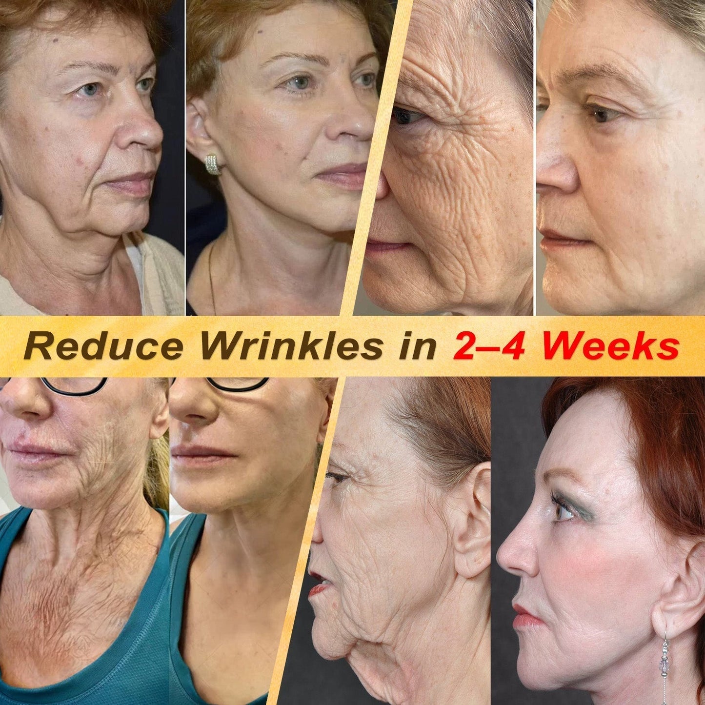 🎁 DON’T LEAVE THIS VIP DEAL BEHIND 80% OFF HISKIN® Skin Repair Cream | Smooth The Look Of Wrinkles, Hydrate & Restore A Youthful Glow + 180-Day Guarantee